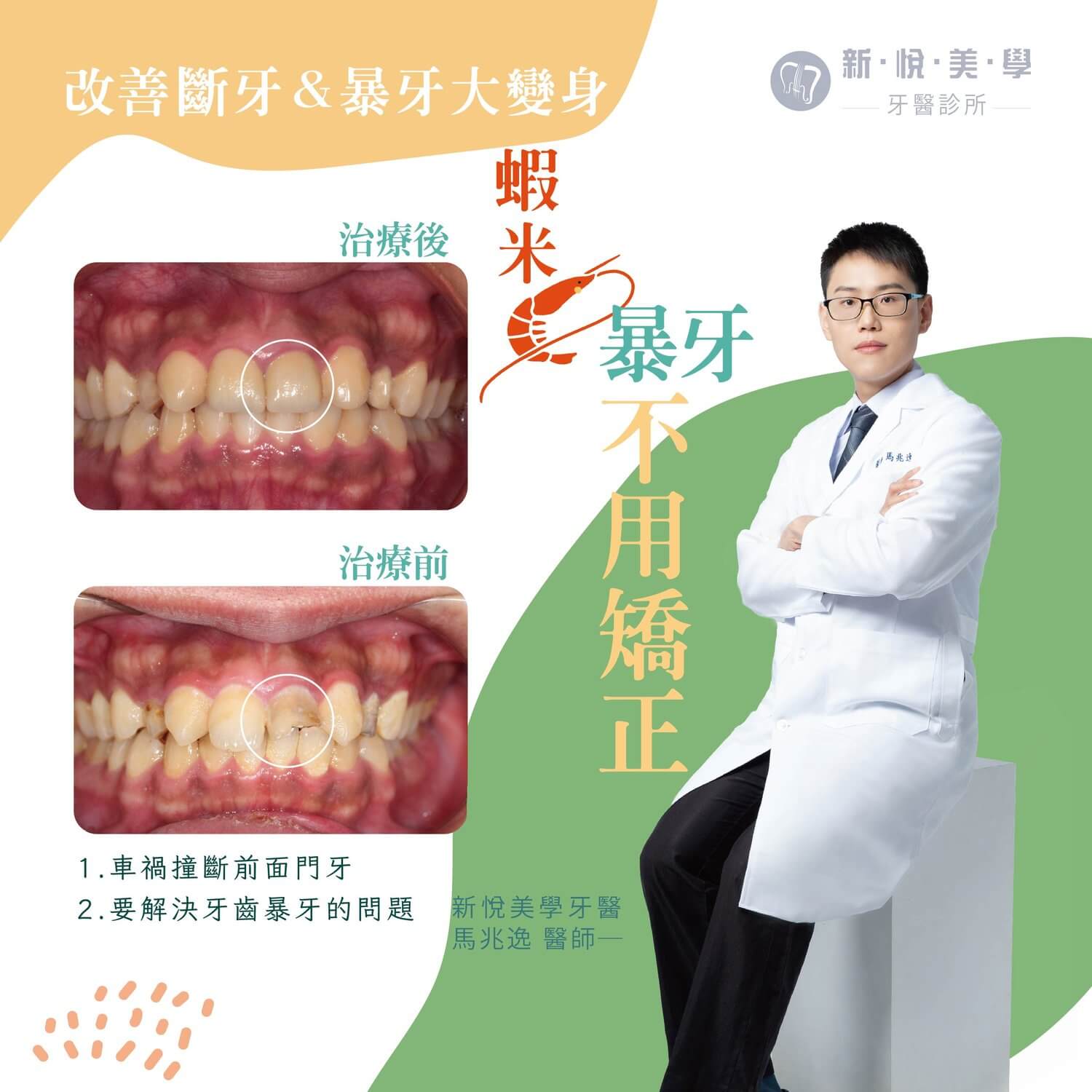 新悅美學牙醫診所的案例分享圖片